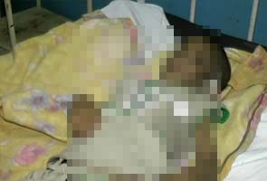 Father Booked For Torturing His 6-Yr-Old Son